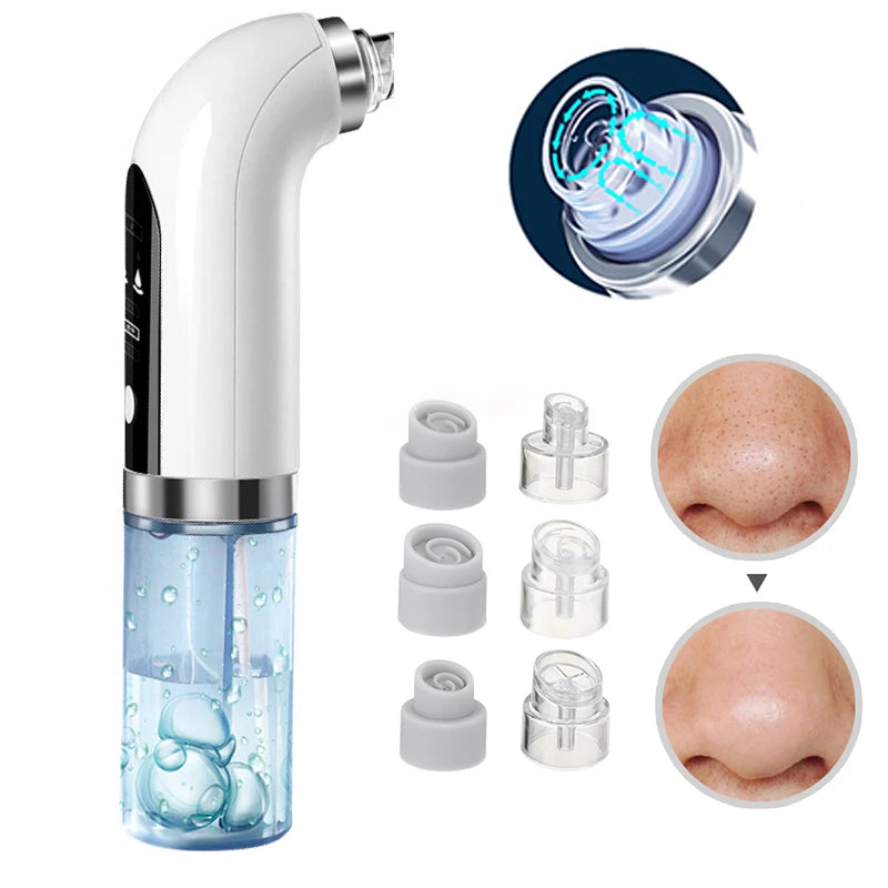 Water Cycle Blackhead Remover and Pore Vacuum Face Cleaner