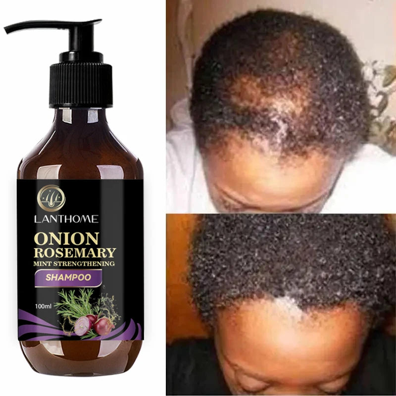 Rosemary Onion Hair Growth Shampoo