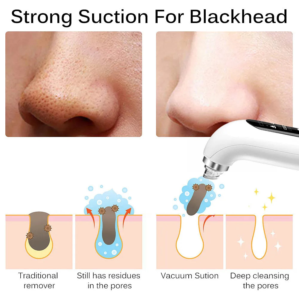 Water Cycle Blackhead Remover and Pore Vacuum Face Cleaner