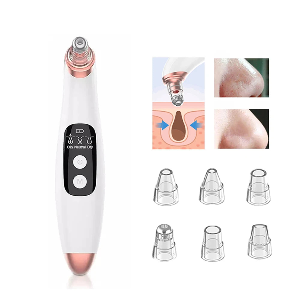 Water Cycle Blackhead Remover and Pore Vacuum Face Cleaner